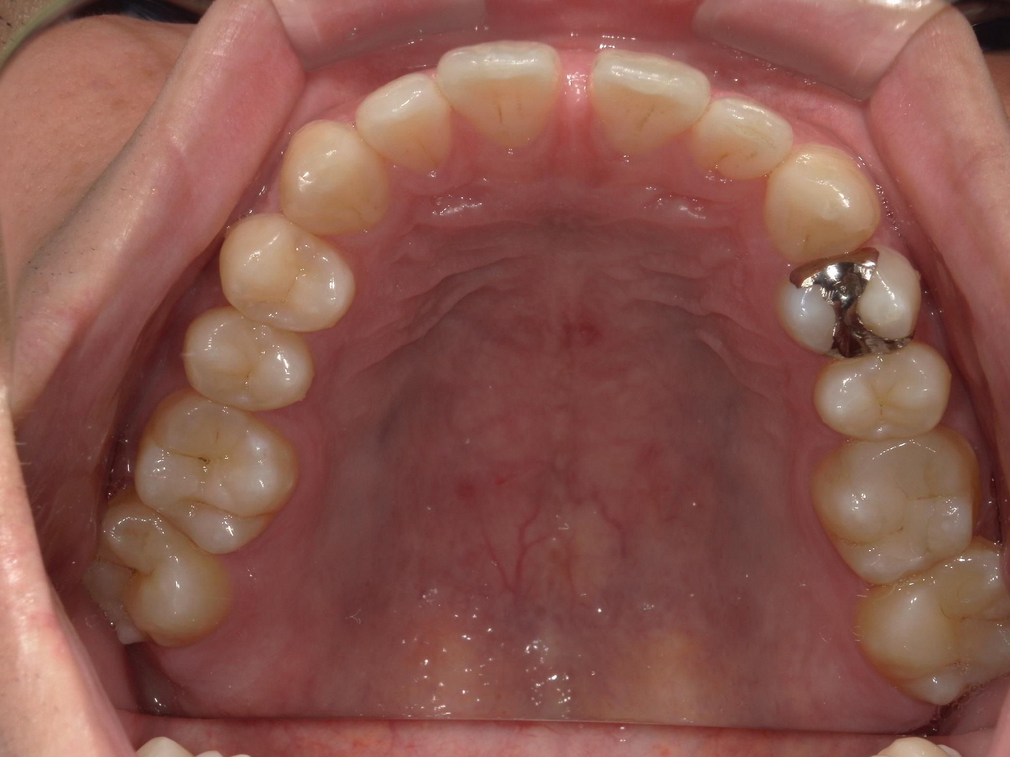 矯正・インプラント