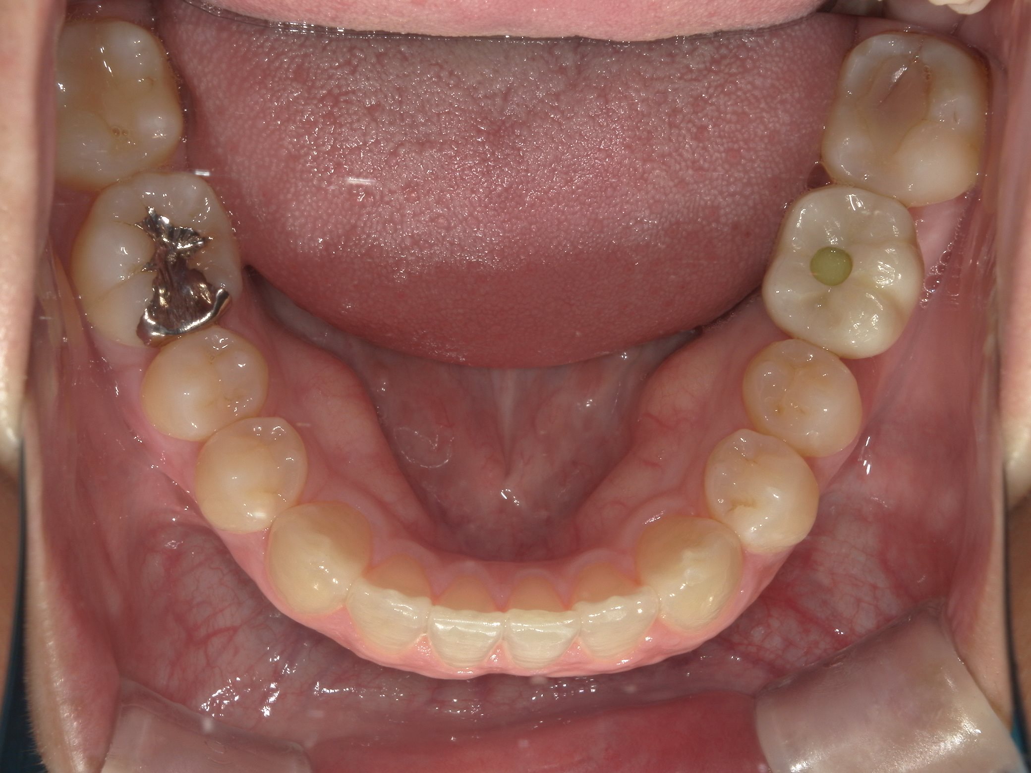 矯正・インプラント