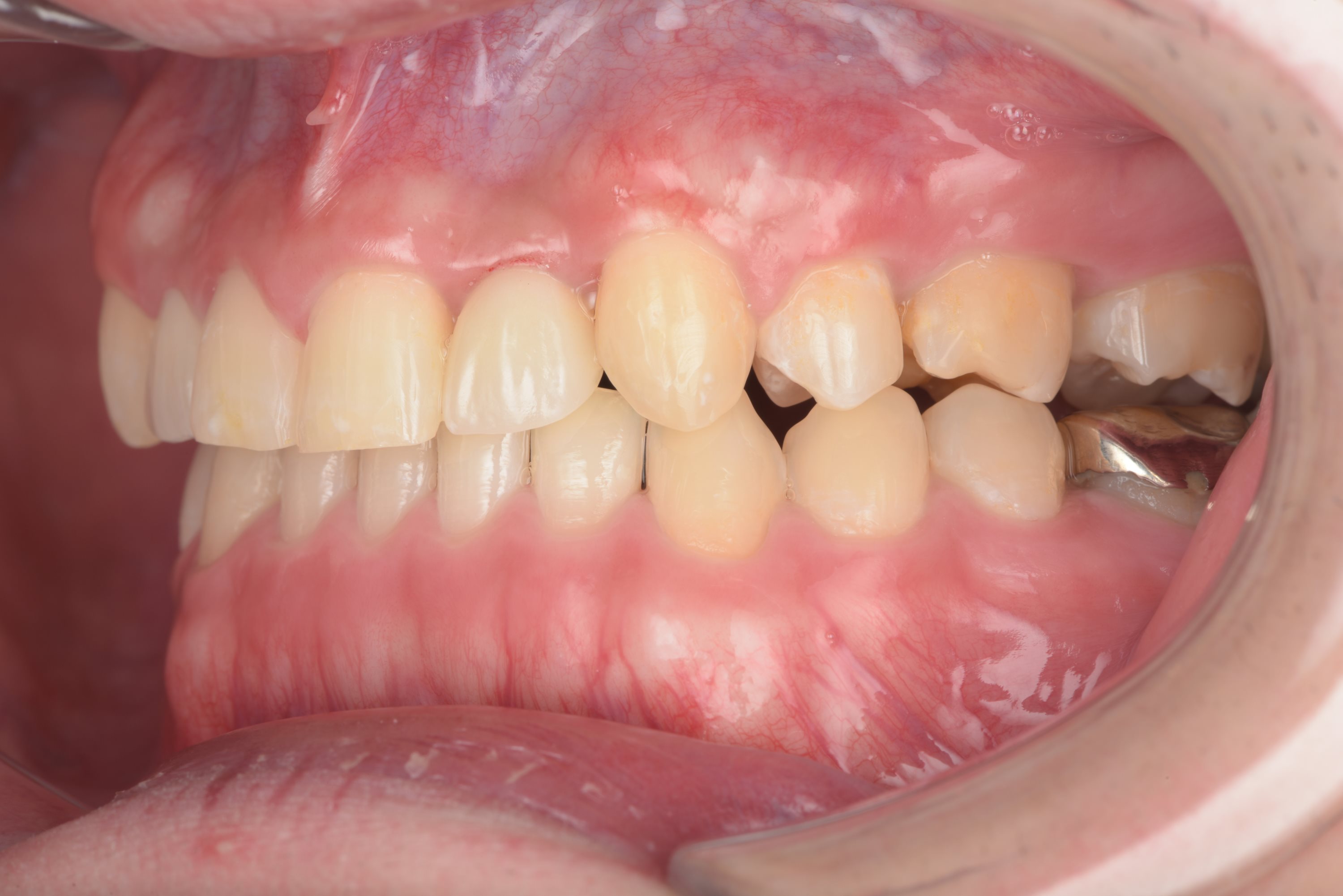 矯正・インプラント