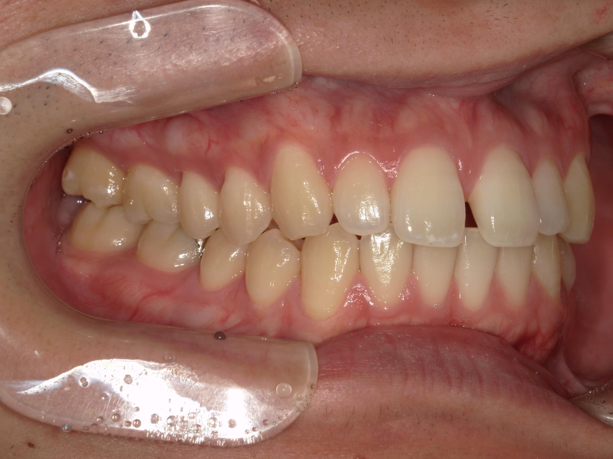 矯正・インプラント