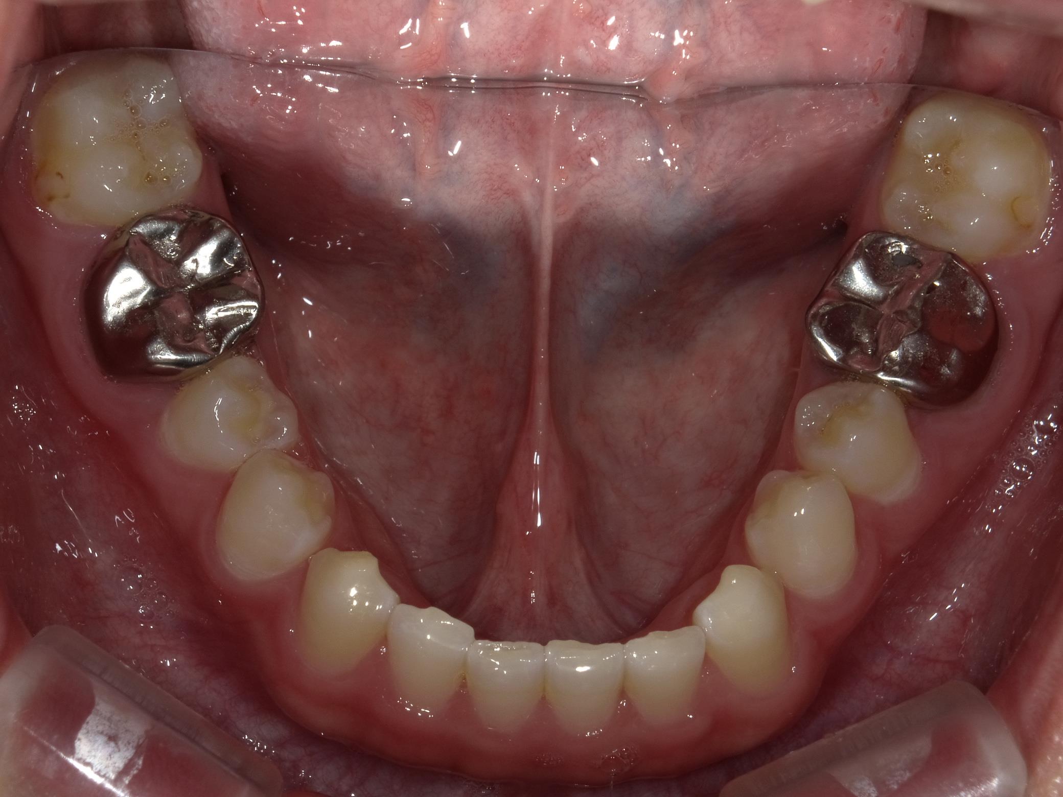 矯正・インプラント