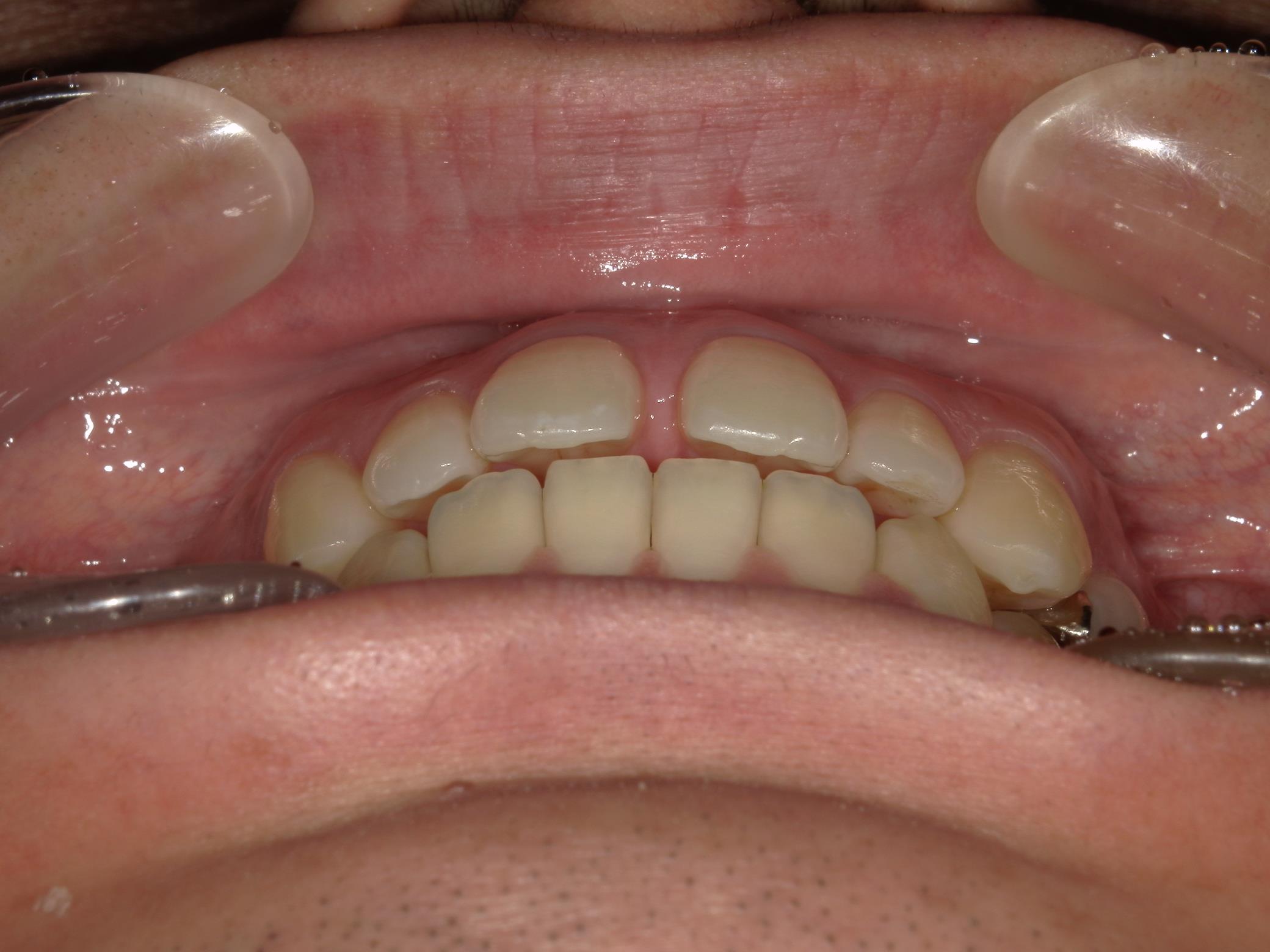 矯正・インプラント