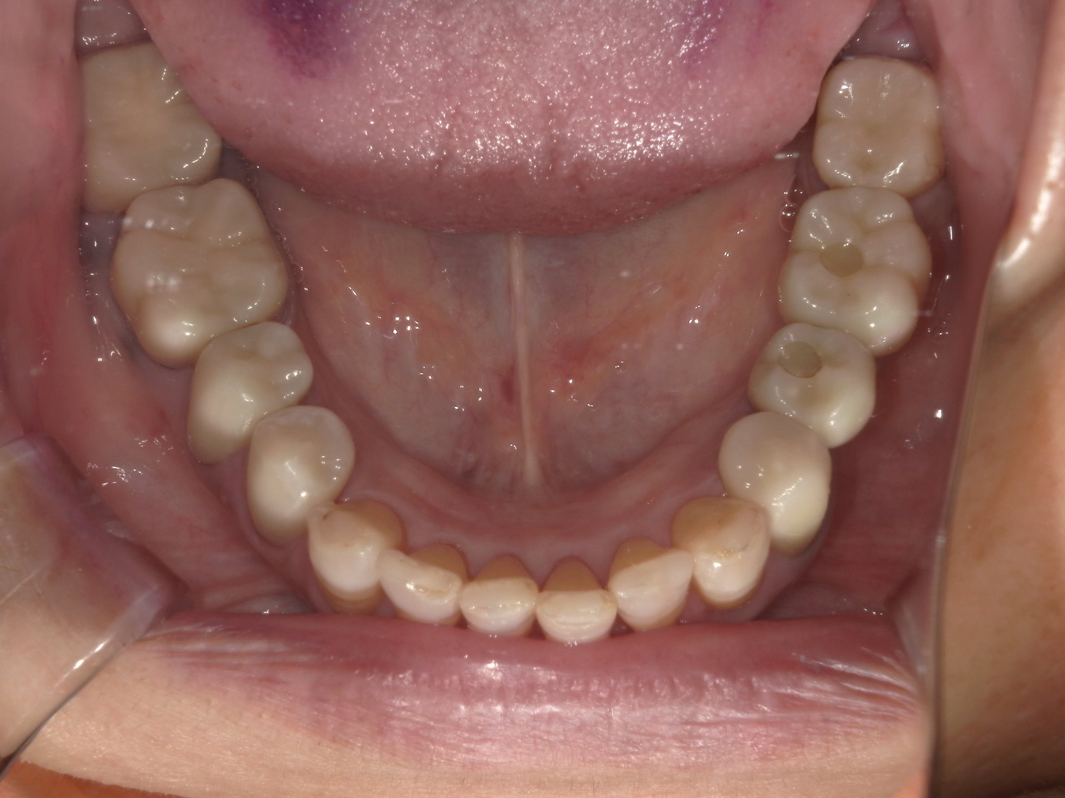 矯正・インプラント