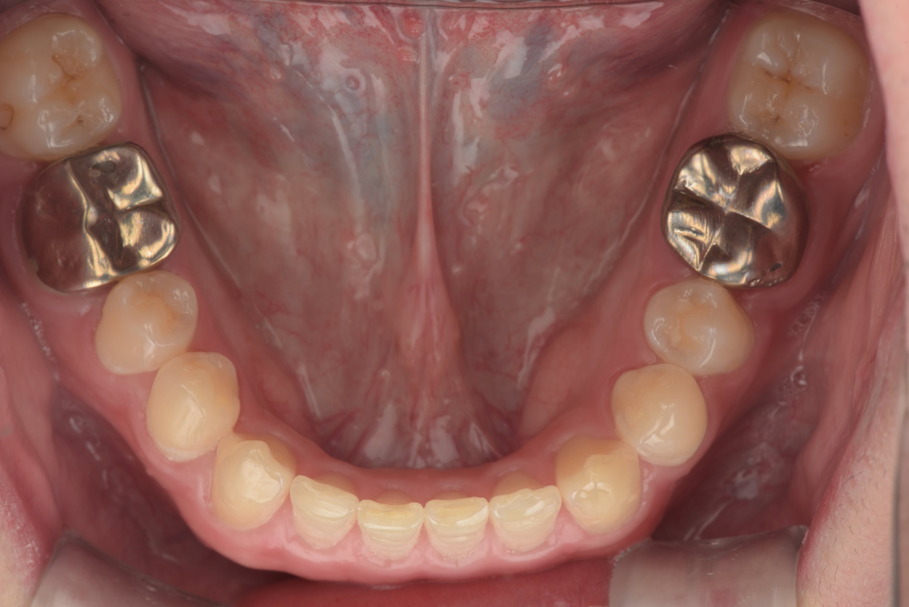 矯正・インプラント