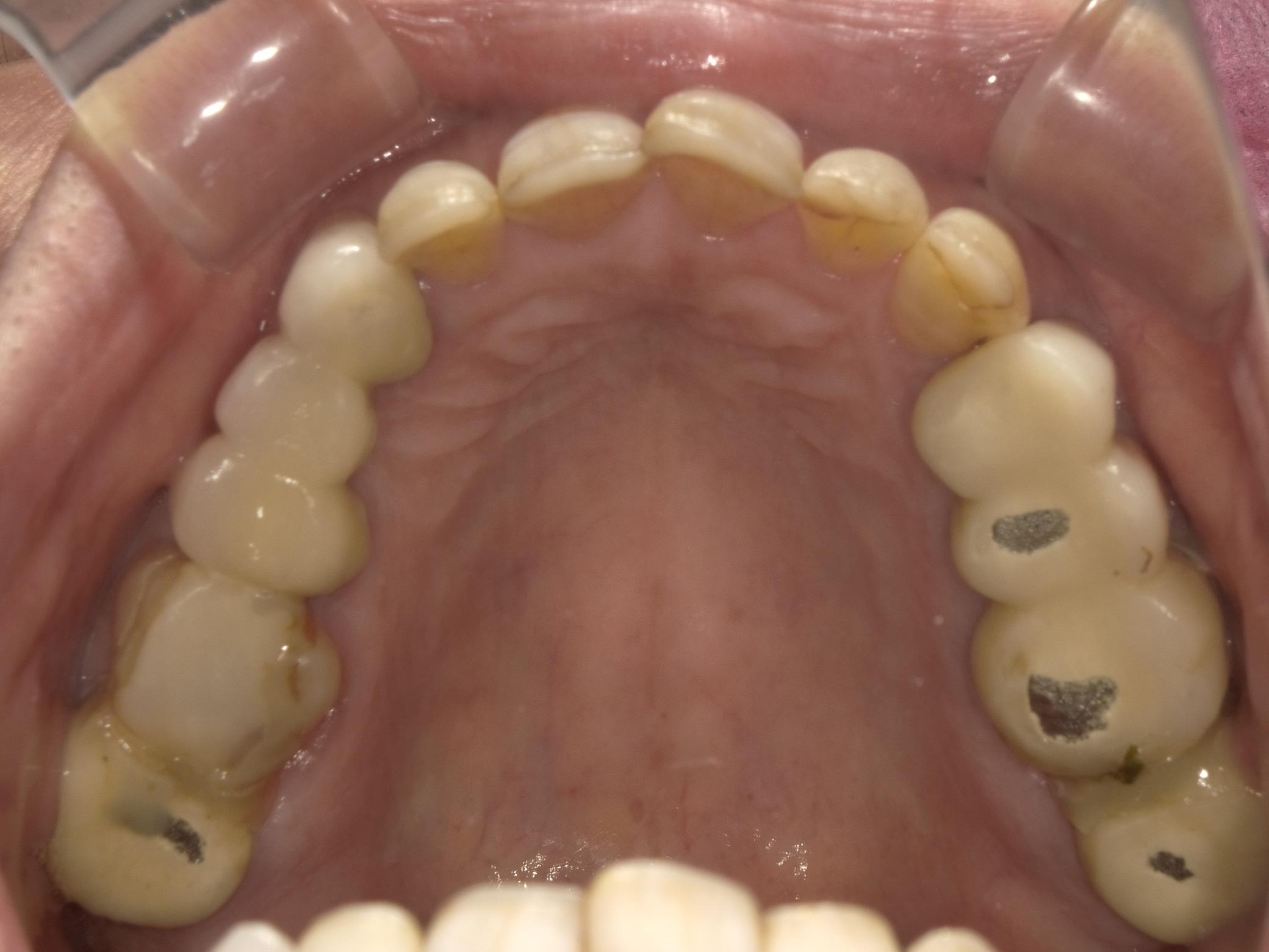 矯正・インプラント