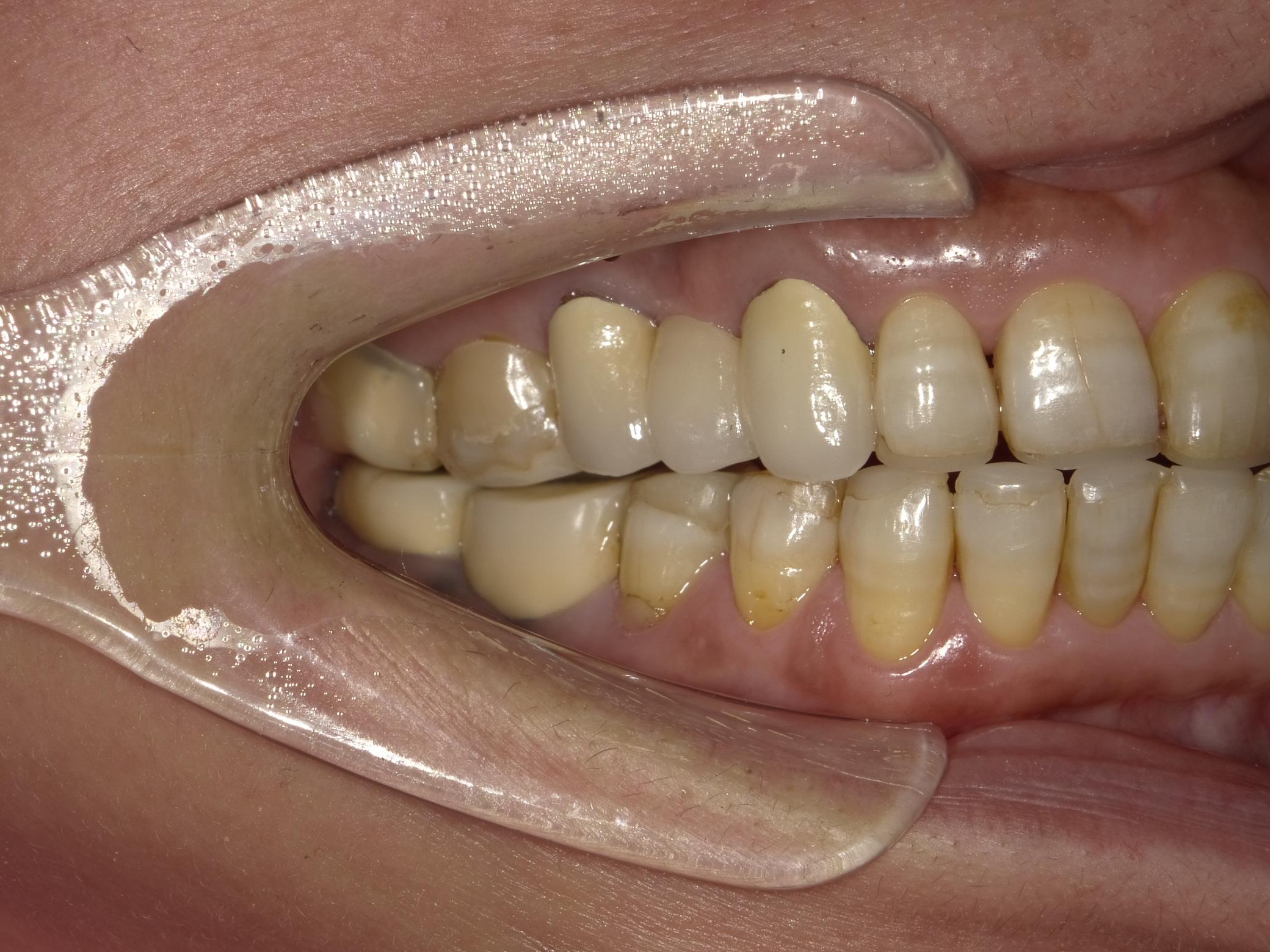 矯正・インプラント