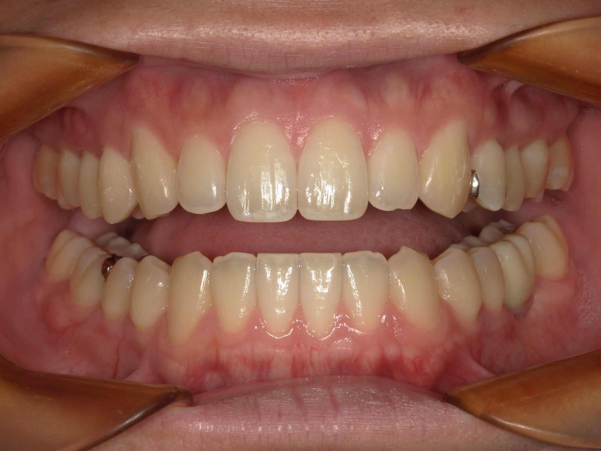 矯正・インプラント