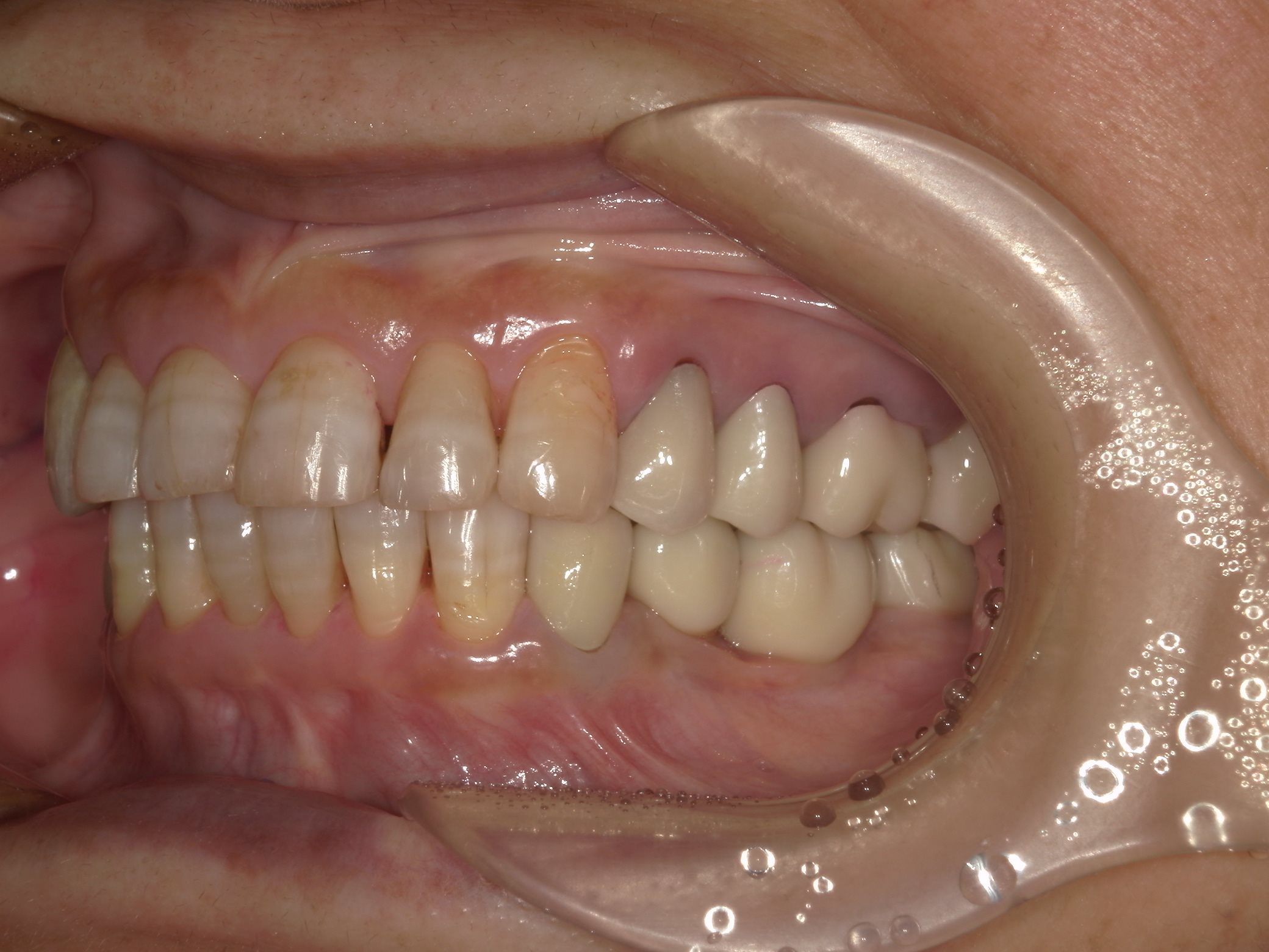 矯正・インプラント