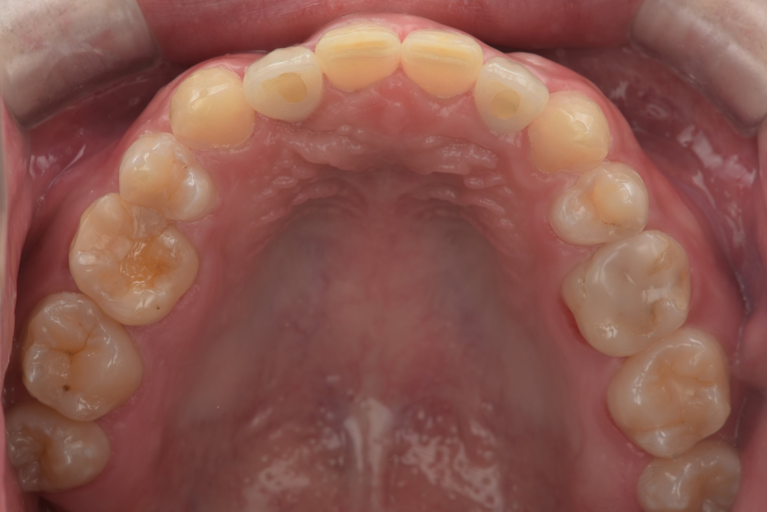 矯正・インプラント