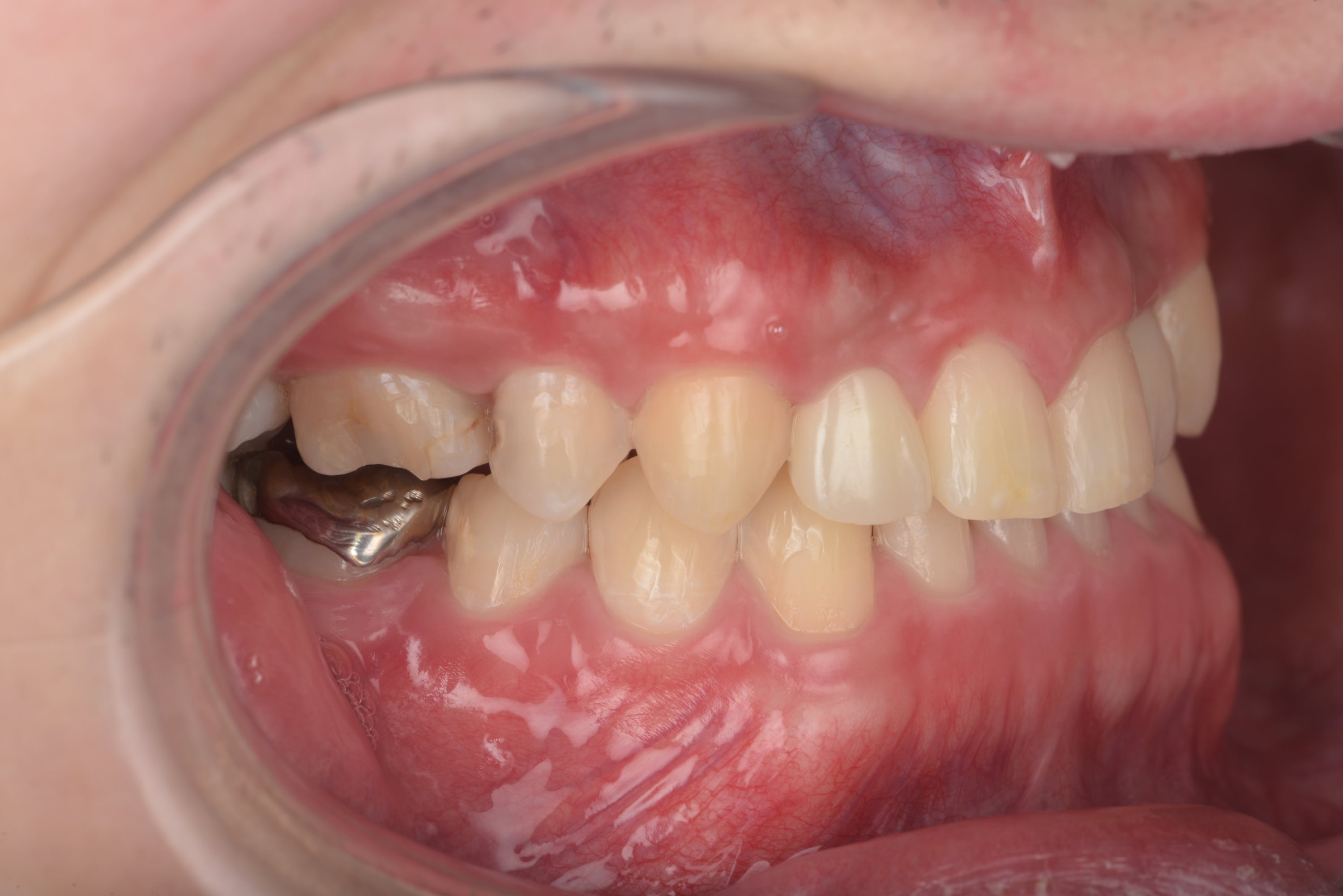 矯正・インプラント