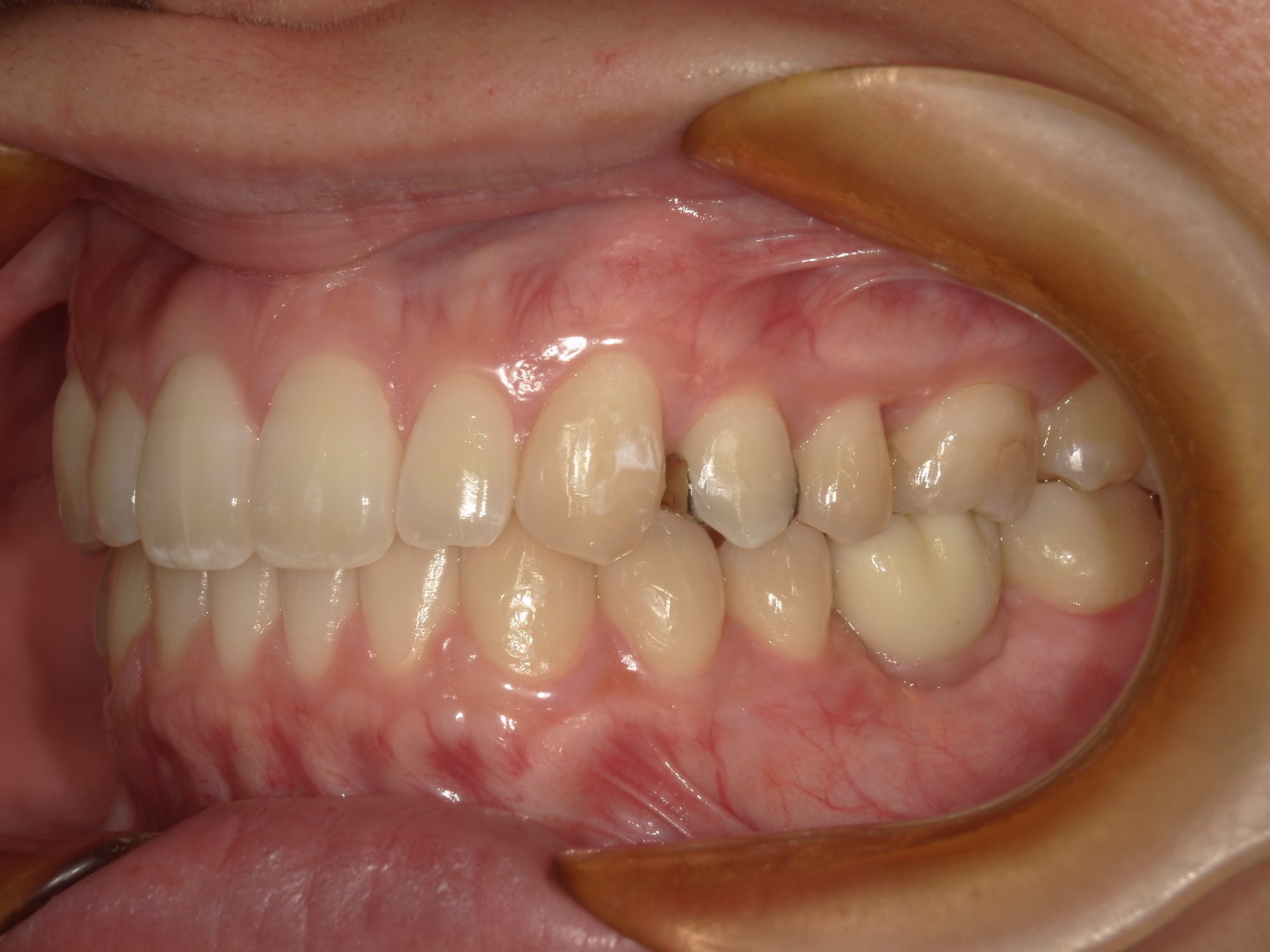 矯正・インプラント