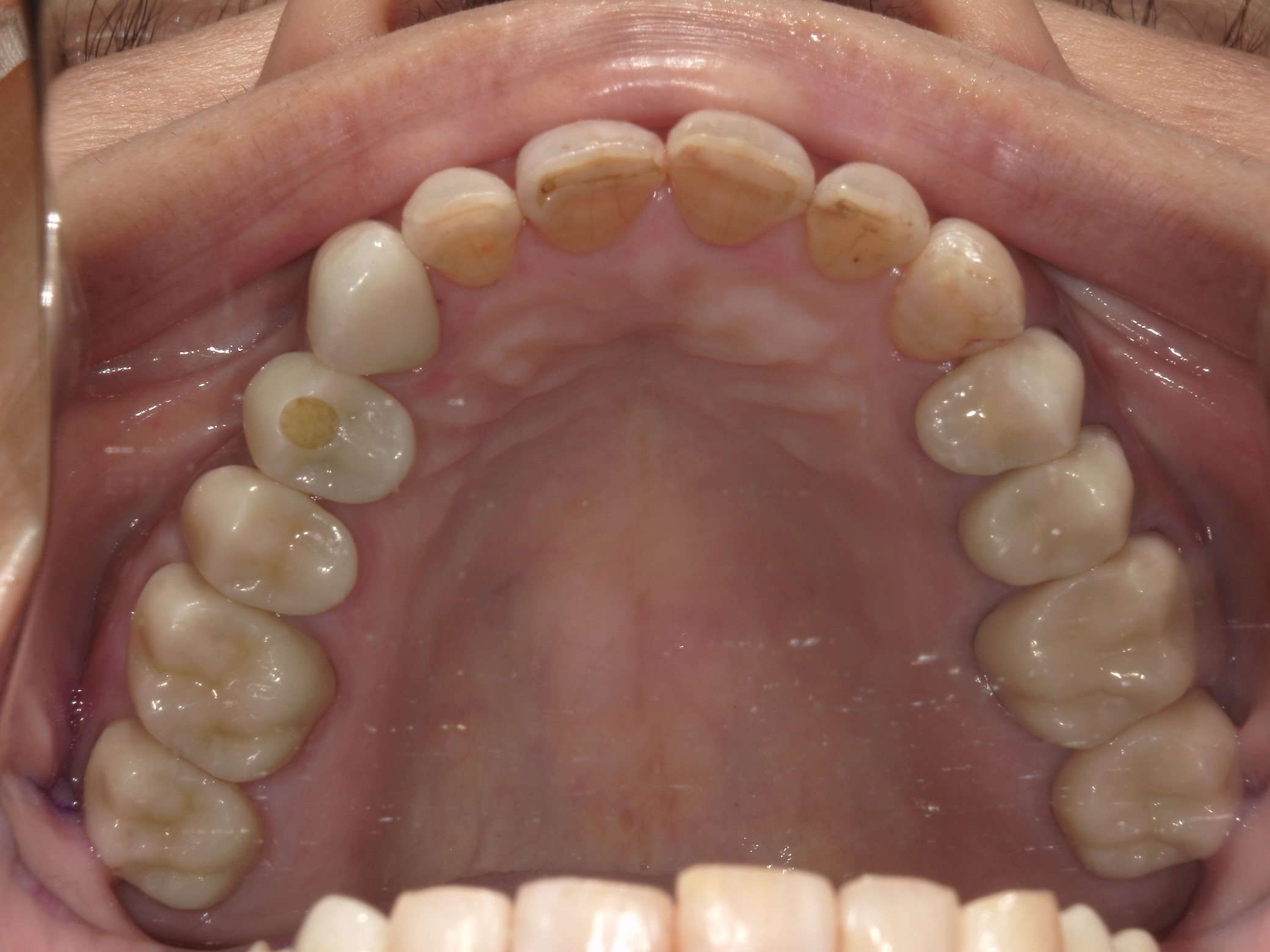 矯正・インプラント