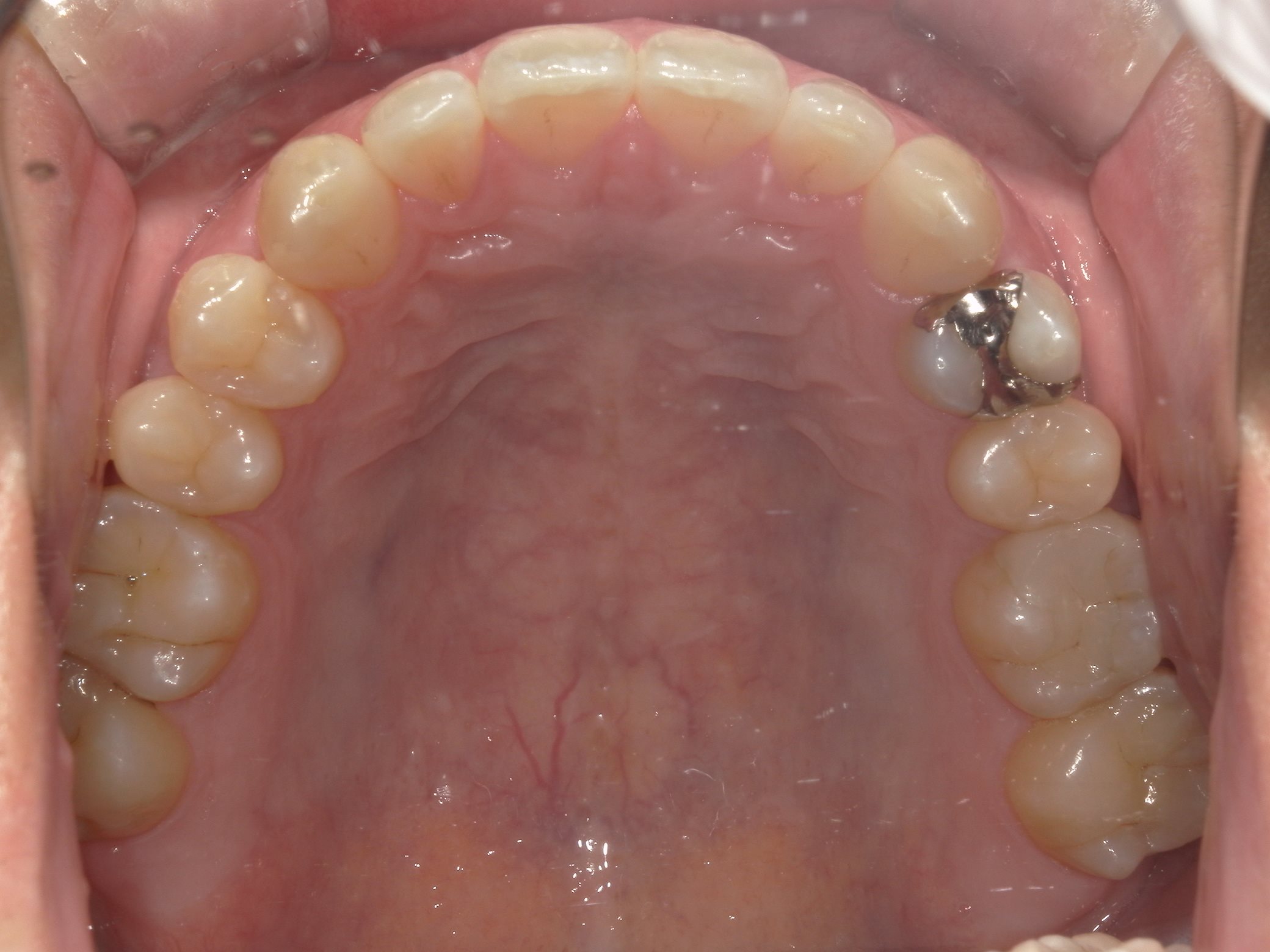 矯正・インプラント