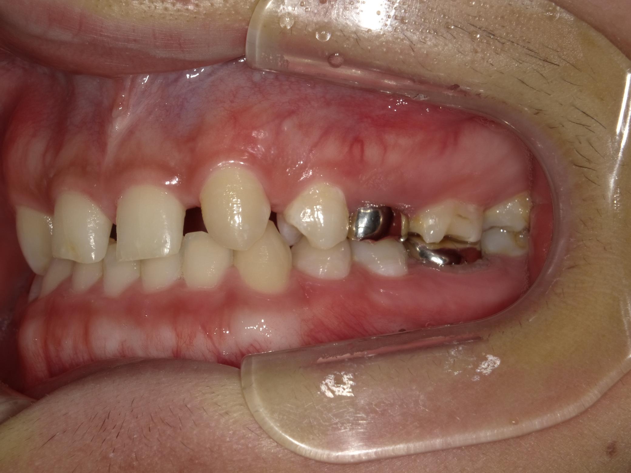 矯正・インプラント