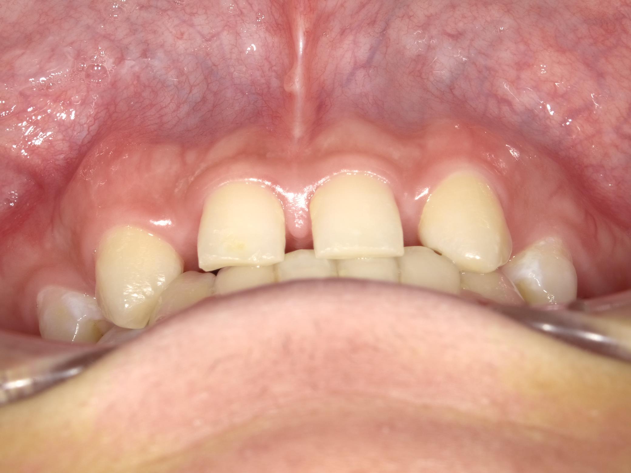 矯正・インプラント