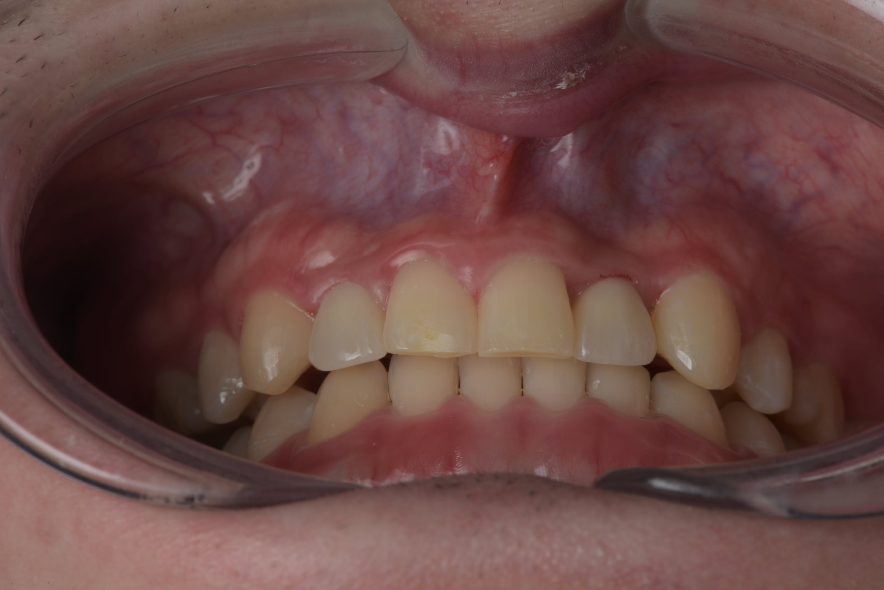 矯正・インプラント