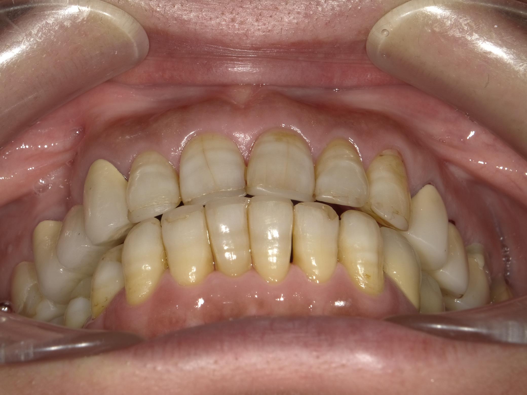 矯正・インプラント