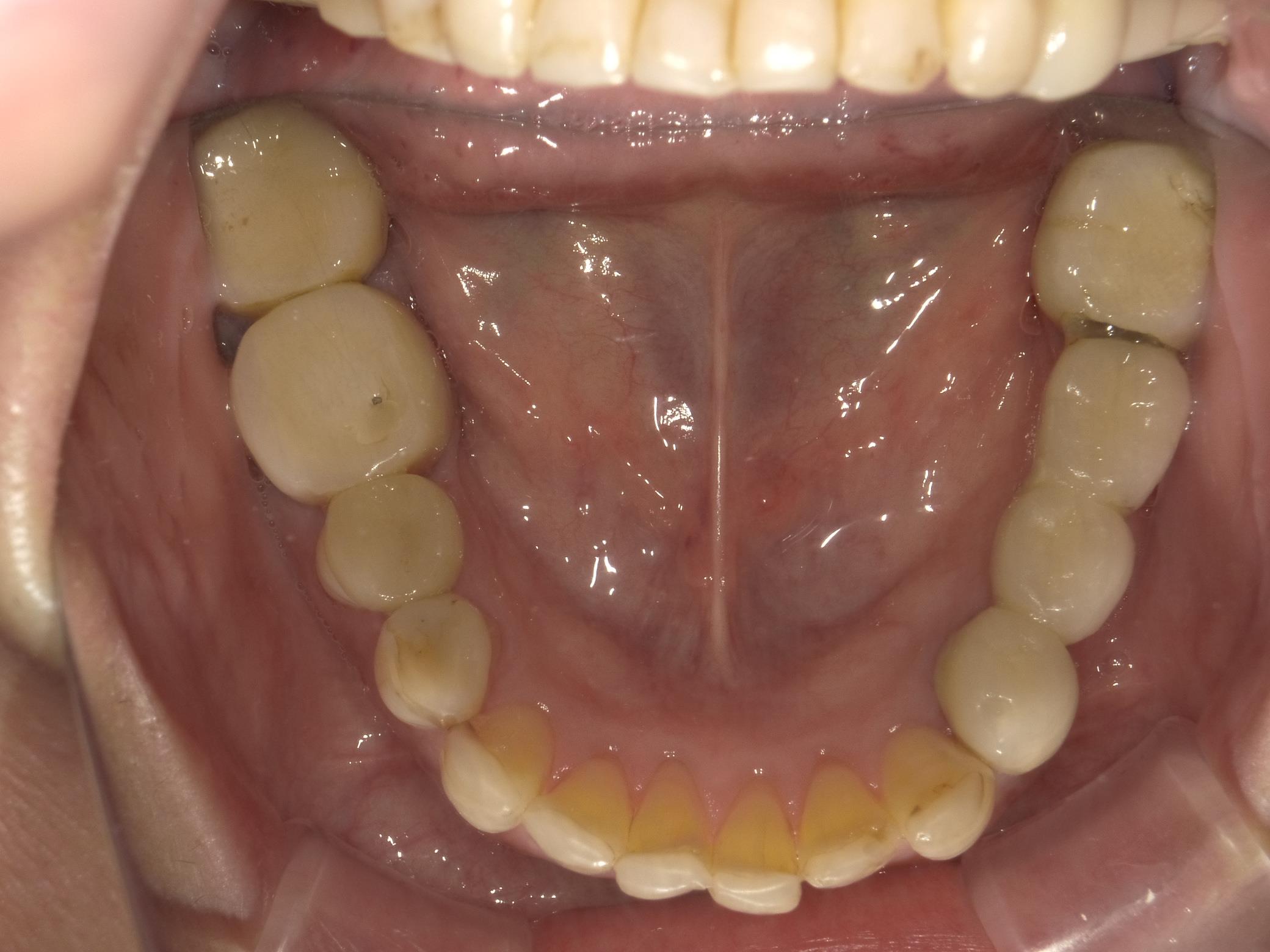 矯正・インプラント