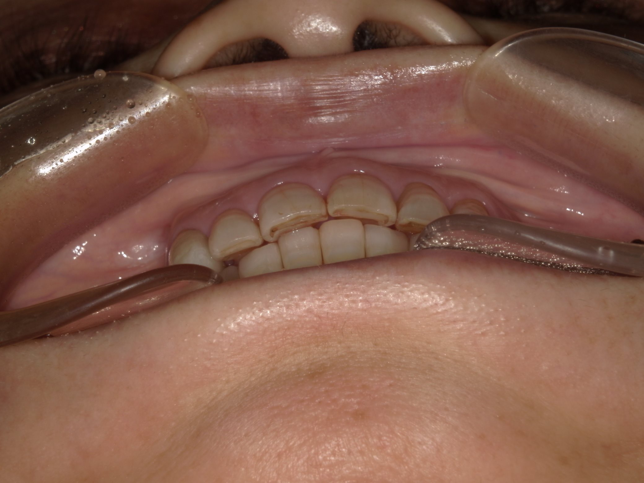 矯正・インプラント