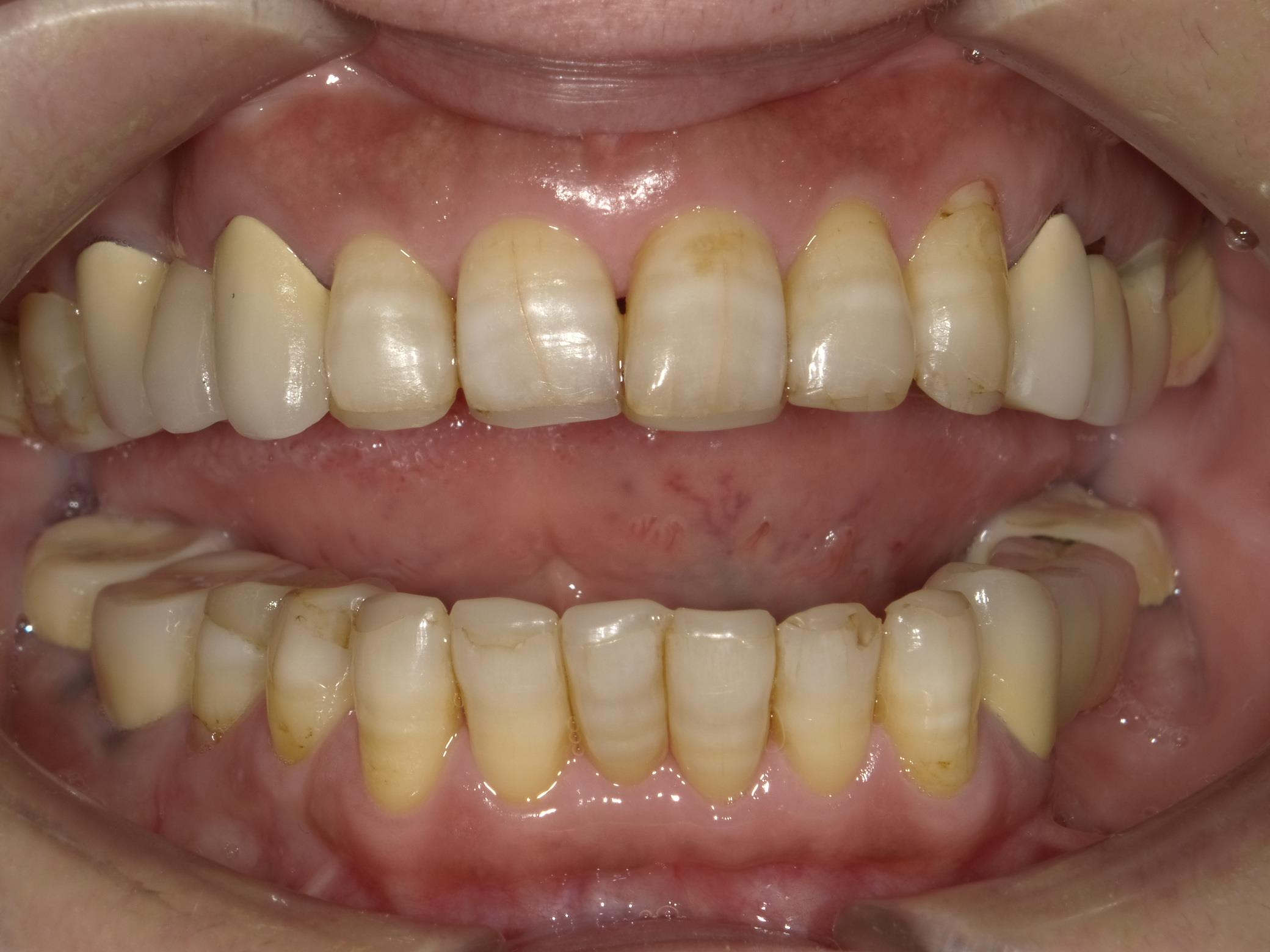 矯正・インプラント