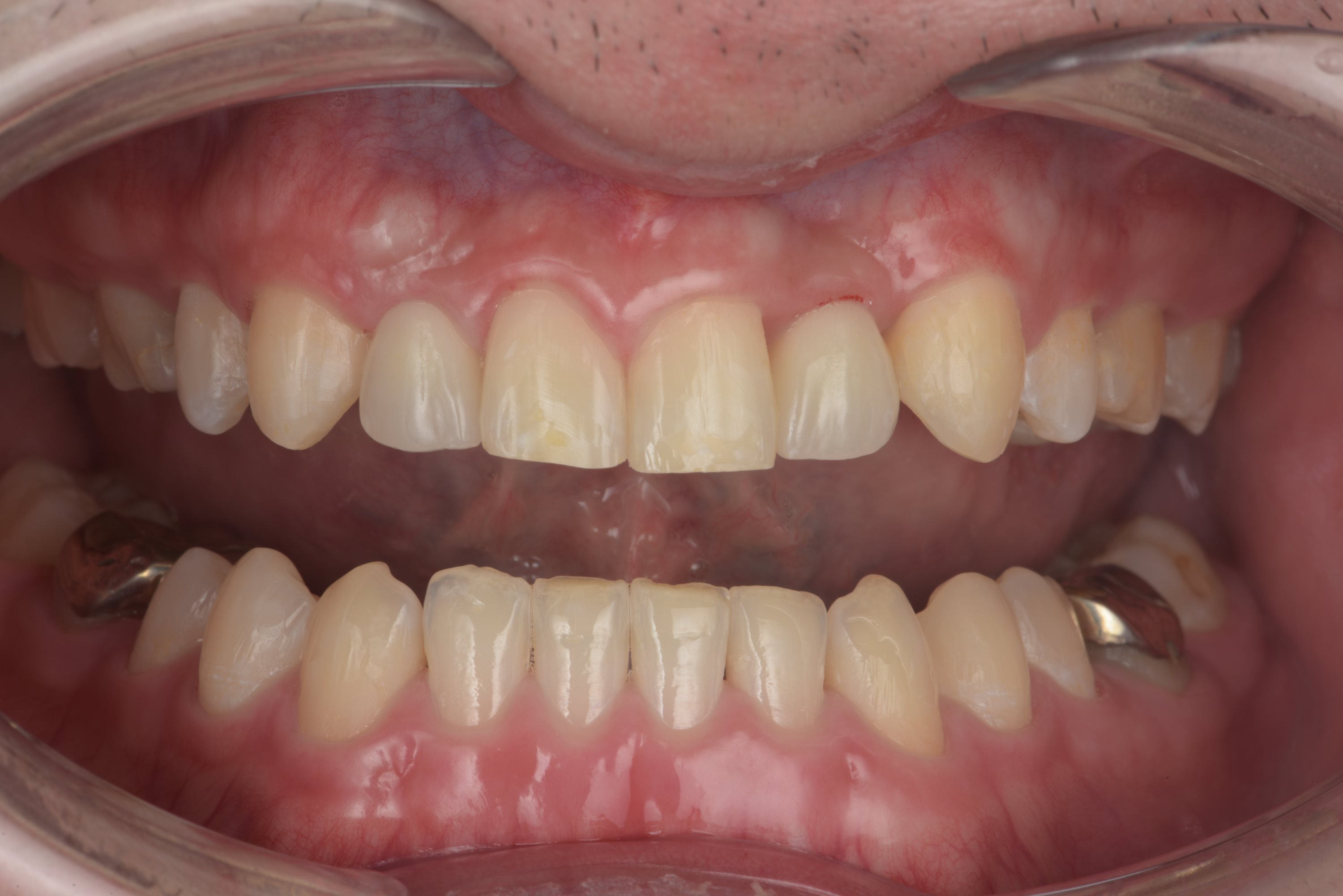 矯正・インプラント