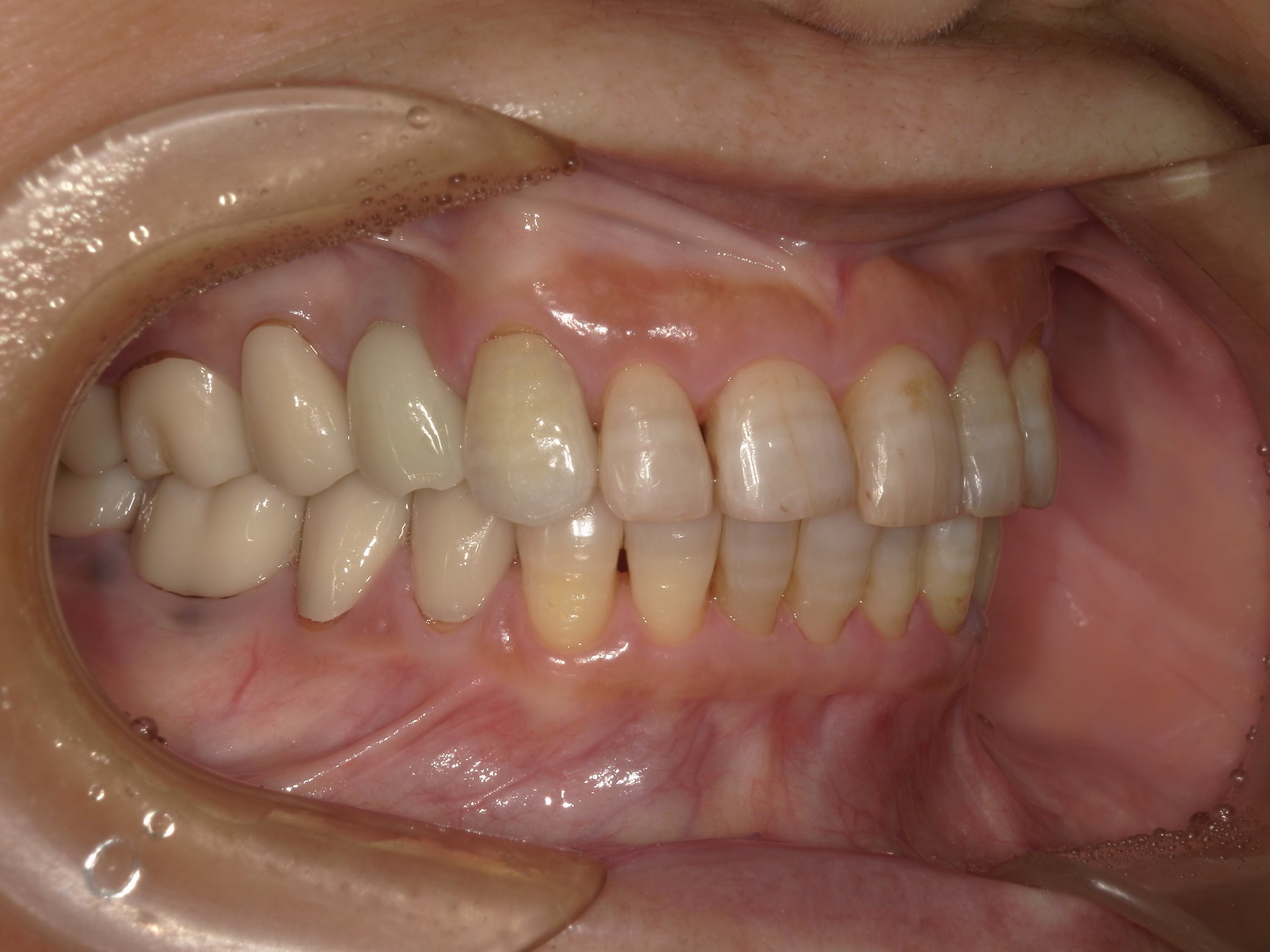 矯正・インプラント