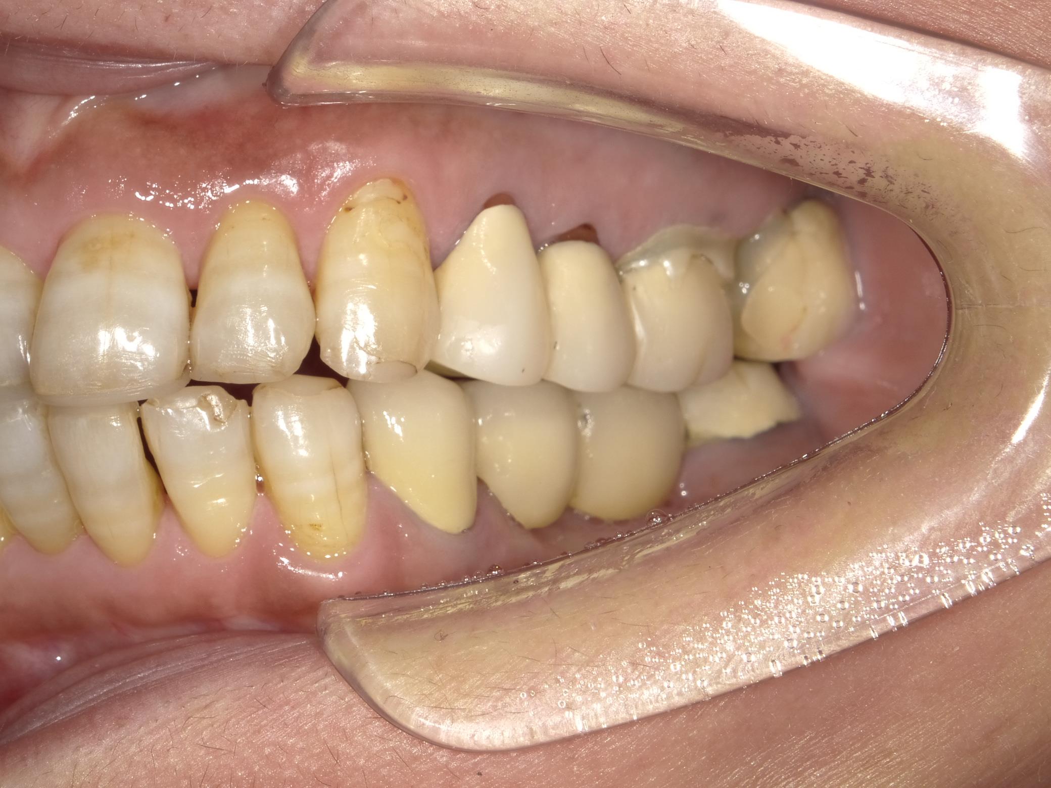 矯正・インプラント