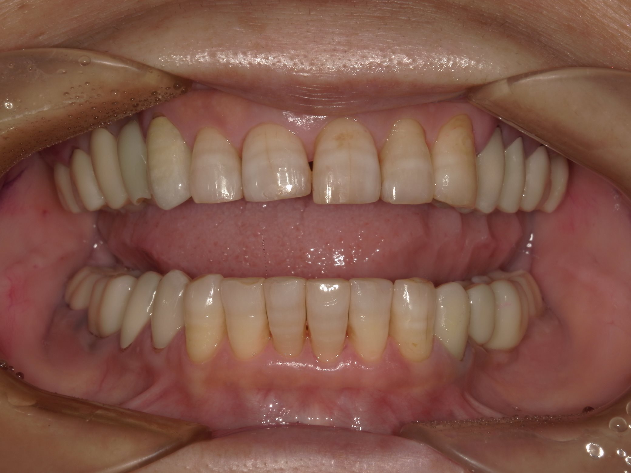 矯正・インプラント