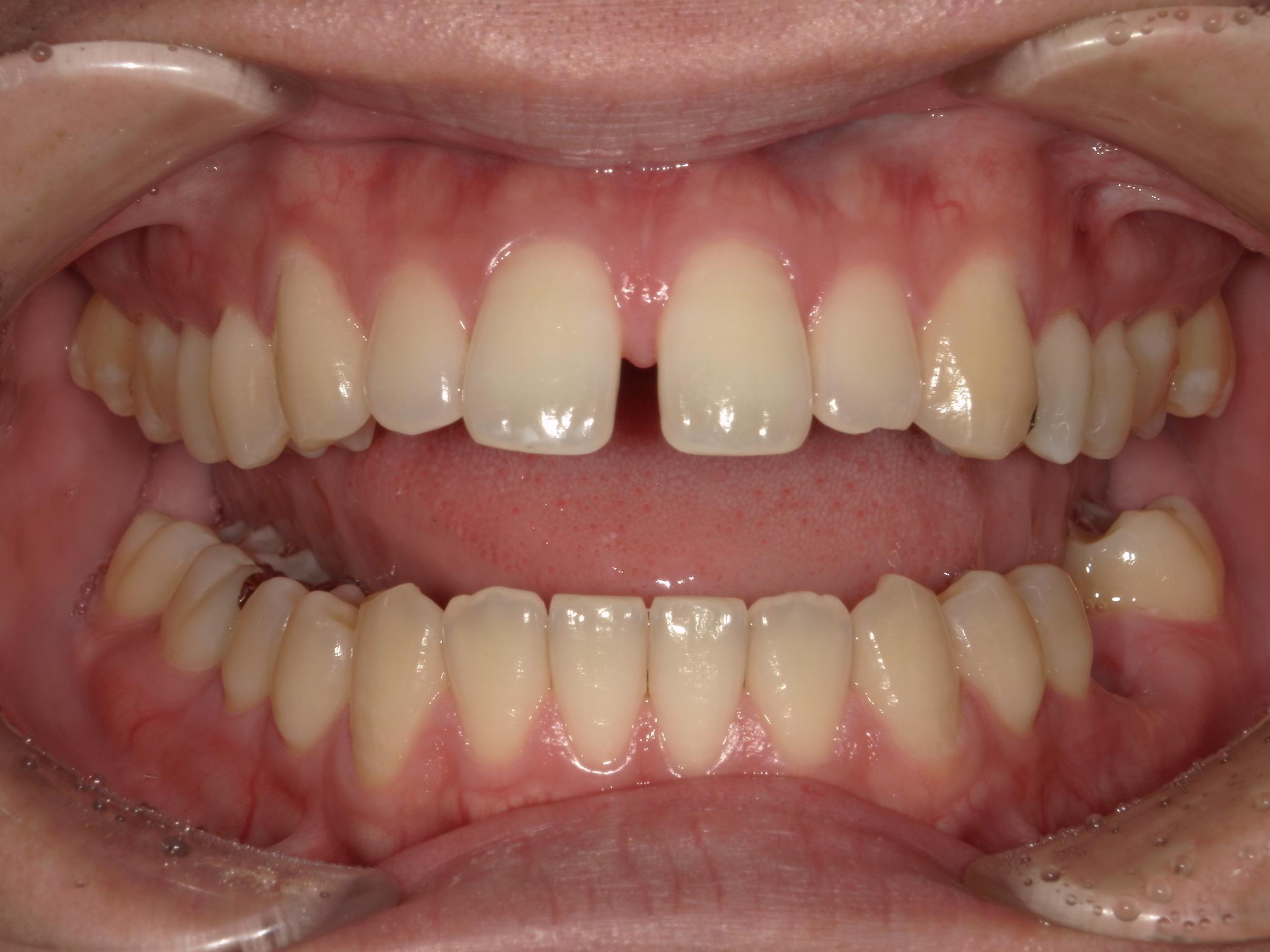 矯正・インプラント