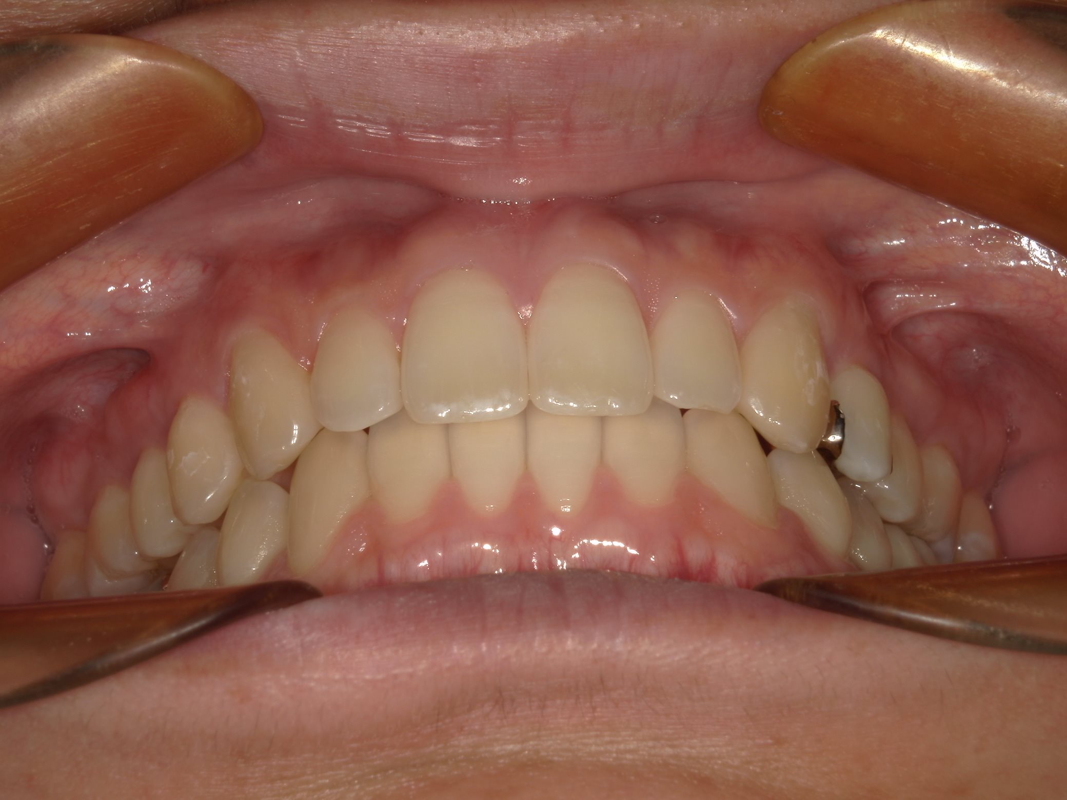 矯正・インプラント