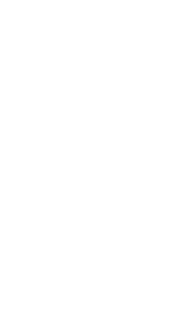 親知らずの抜歯虫歯治療