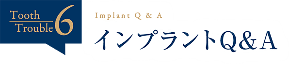 インプラントQ&A
