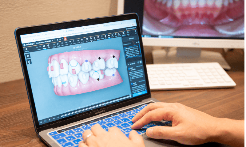 3Dデータを元にカウンセリング