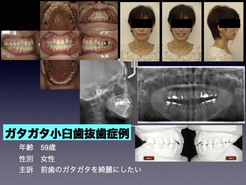 精密診断