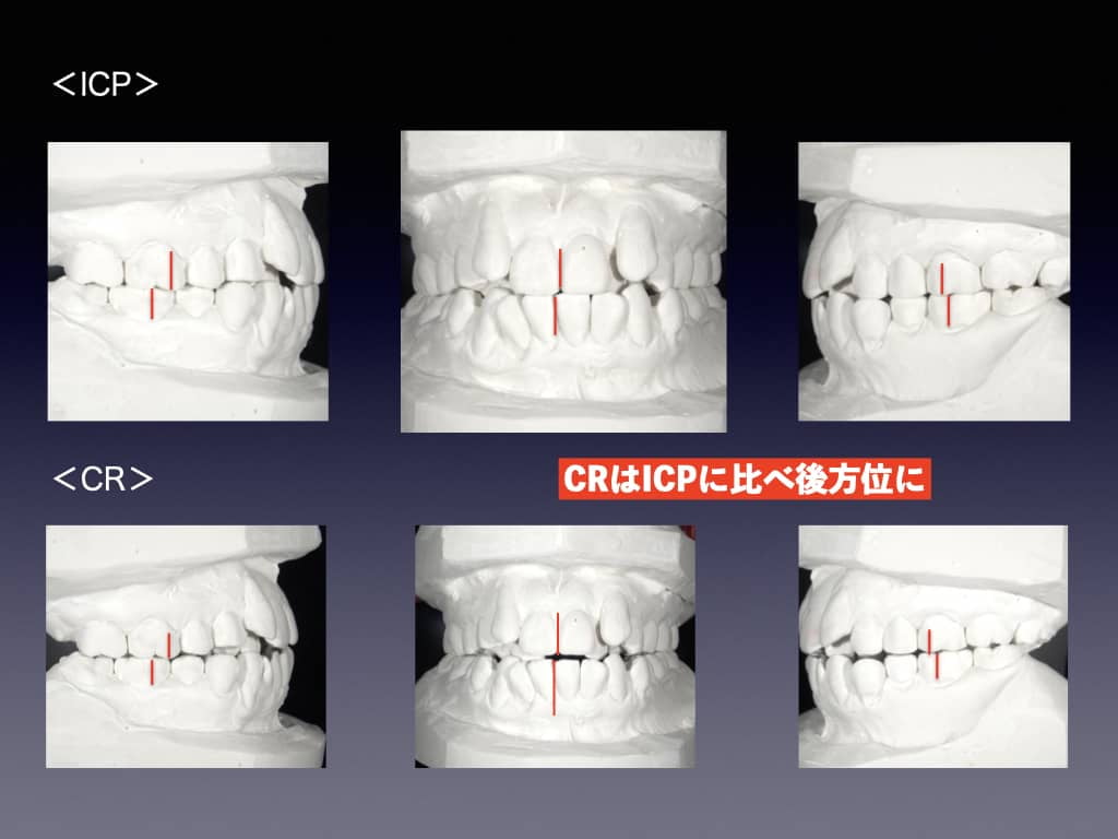 精密診断