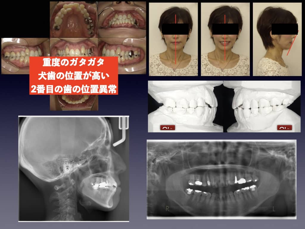 精密診断