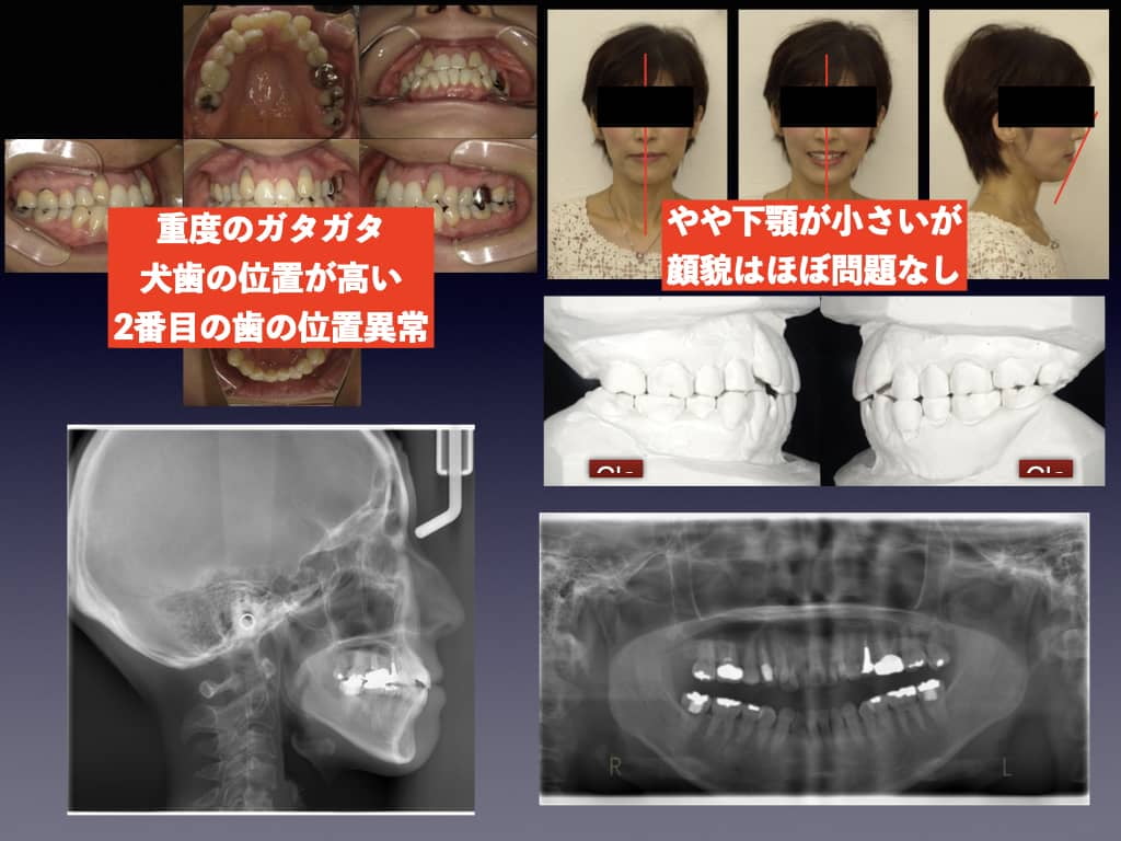 精密診断