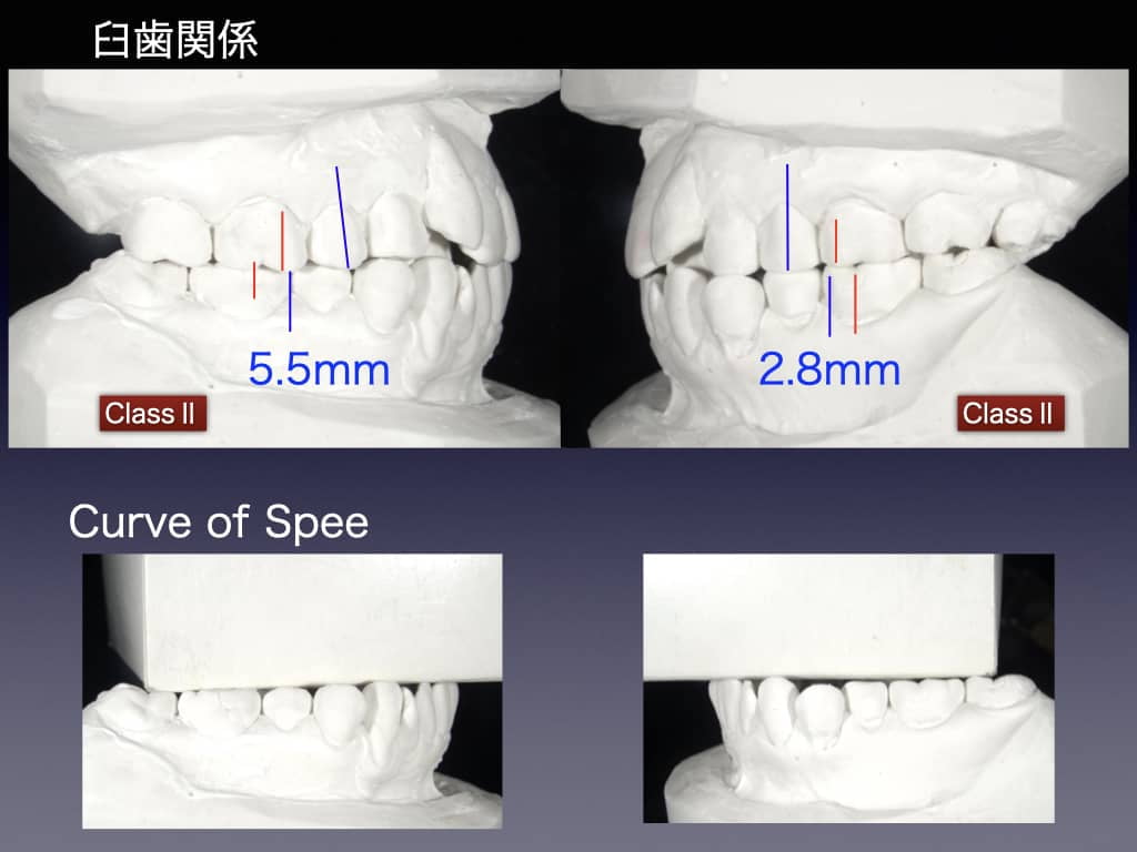 精密診断