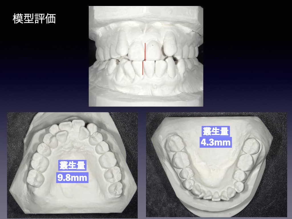 精密診断